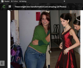 Illustration for article titled Site Uses Pic of Woman with Anorexia in 'Amazing' Weight Loss Post